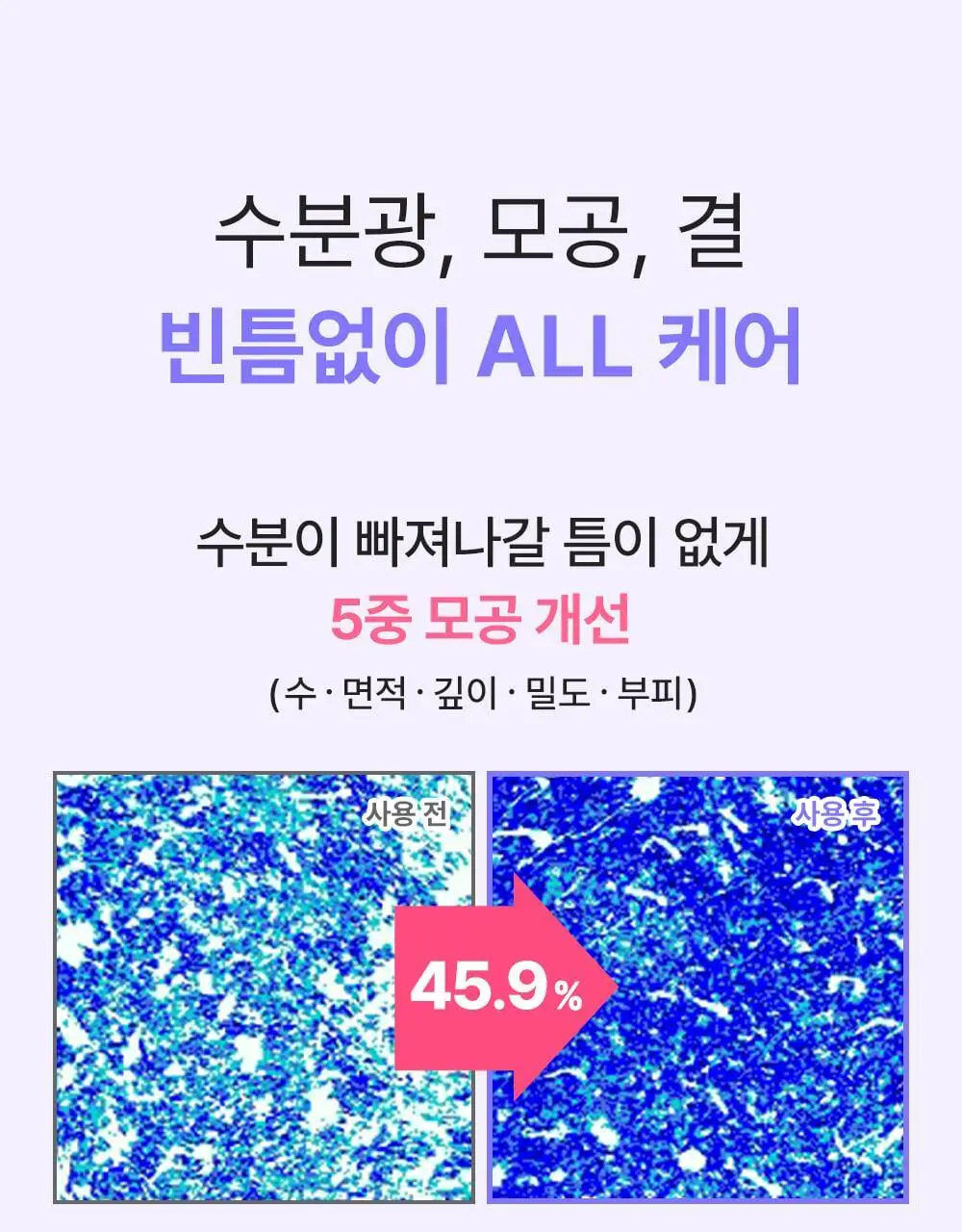 [모공교정] 아이디플라코스메틱 엑소브이 프로리프팅 세트(리프팅 앰플 5ml + MTS 롤러) 상세페이지 31